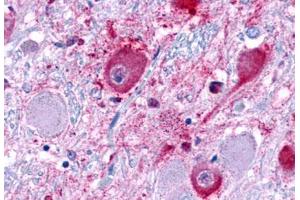 Anti-NPY1R antibody  ABIN1049121 IHC staining of human brain.