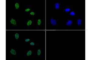 Immunofluorescence of Rabbit Anti-Histone H3 [p Thr11, p Ser10] Antibody. (Histone 3 anticorps  (pSer10, pThr11))