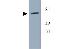 Western blot analysis of YAP1 using YAP1 polyclonal antibody  in transfected HEK 293 cell lysate. (YAP1 anticorps)