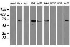 Image no. 2 for anti-Mahogunin, Ring Finger 1 (MGRN1) antibody (ABIN1499459) (Mahogunin RING Finger Protein 1 anticorps)