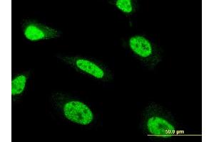 Immunofluorescence of monoclonal antibody to ZNF71 on HeLa cell. (ZNF71 anticorps  (AA 1-100))