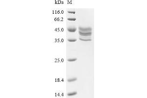 (Tris-Glycine gel) Discontinuous SDS-PAGE (reduced) with 5 % enrichment gel and 15 % separation gel.