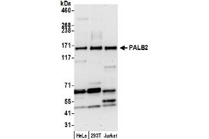 Western Blotting (WB) image for anti-Partner and Localizer of BRCA2 (PALB2) (AA 200-250) antibody (ABIN7451934)
