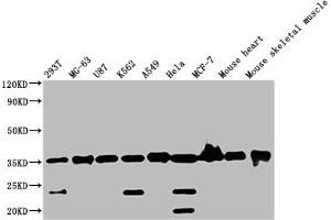 Western Blot Positive WB detected in: Mouse skeletal muscle tissue All lanes: ANKRD23 antibody at 2. (ANKRD23 anticorps  (AA 1-200))