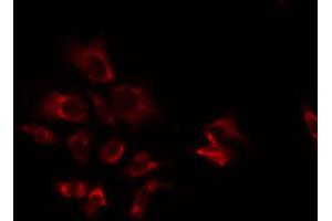 ABIN6274879 staining HT29 by IF/ICC. (ATP5S anticorps  (Internal Region))
