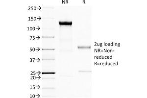 SDS-PAGE Analysis Purified BRCA1 Mouse Monoclonal Antibody (BRCA1/1398). (BRCA1 anticorps  (AA 445-620))