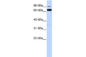WB Suggested Anti-IKBKB Antibody Titration:  0. (IKBKB anticorps  (Middle Region))