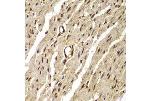 Immunohistochemistry of paraffin-embedded human colon using PSMB8 antibody at dilution of 1:100 (x400 lens).