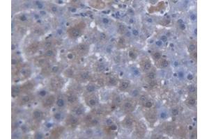 DAB staining on IHC-P; Samples: Rat Liver Tissue (SLC25A20 anticorps  (AA 1-211))