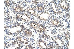 Immunohistochemistry (IHC) image for anti-Arginase, Liver (ARG1) (N-Term) antibody (ABIN2773866)