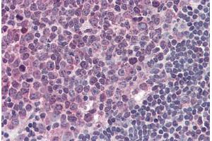 Human Tonsil (formalin-fixed, paraffin-embedded) stained with TLR4 antibody ABIN334262 at 5 ug/ml followed by biotinylated anti-mouse IgG secondary antibody ABIN481714, alkaline phosphatase-streptavidin and chromogen.