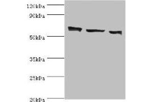 Western blot All lanes: COIL antibody at 3 μg/mL Lane 1: MCF-7 whole cell lysate Lane 2: Hela whole cell lysate Lane 3: HepG2 whole cell lysate Secondary Goat polyclonal to rabbit IgG at 1/10000 dilution Predicted band size: 63 kDa Observed band size: 63 kDa (Coilin anticorps  (AA 297-576))