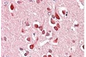 Image no. 1 for anti-Unc-5 Homolog C (C. Elegans) (Unc5c) (Internal Region) antibody (ABIN452309) (Unc5c anticorps  (Internal Region))