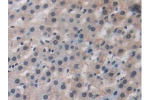 Detection of RAGE in Rat Liver Tissue using Polyclonal Antibody to Renal Tumor Antigen (RAGE)