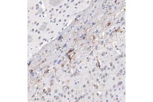 Immunohistochemistry of paraffin embedded mouse brain using ACyclaseI (ABIN7072958) at dilution of 1:650 (300x lens) (ADCY1 anticorps)