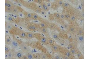 DAB staining on IHC-P; Samples: Human Liver Tissue (SHB anticorps  (AA 252-507))