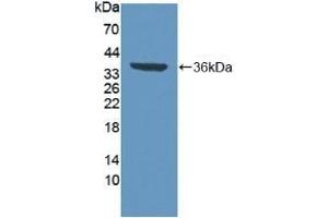 Detection of Recombinant VCP, Human using Polyclonal Antibody to Valosin Containing Protein (VCP) (VCP anticorps  (AA 125-371))