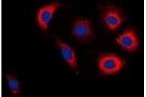 Immunofluorescent analysis of EGFR (pY1016) staining in Jurkat cells. (EGFR anticorps  (C-Term, pTyr1016))
