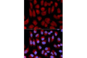 Immunofluorescence analysis of U2OS cell using TAP2 antibody. (TAP2 anticorps  (AA 430-680))
