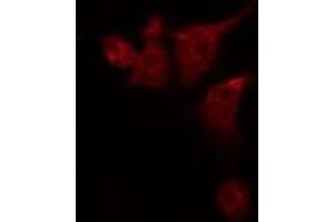 ABIN6276009 staining 293T by IF/ICC. (G Protein-Coupled Receptor 133 anticorps)