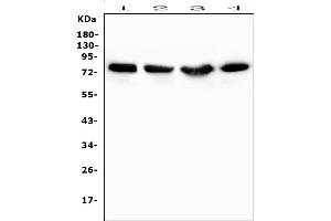Western blot analysis of PRKCD using anti-PRKCD antibody (ABIN7601631).