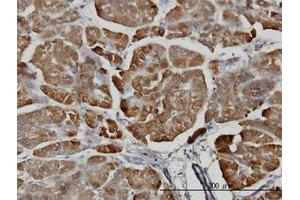 Image no. 1 for anti-Carboxypeptidase B1 (Tissue) (CPB1) (AA 14-418) antibody (ABIN598622) (CPB1 anticorps  (AA 14-418))