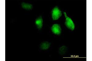 Immunofluorescence of purified MaxPab antibody to LRP1 on HeLa cell.