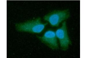 ICC/IF analysis of LDHB in HeLa cells line, stained with DAPI (Blue) for nucleus staining and monoclonal anti-human LDHB antibody (1:100) with goat anti-mouse IgG-Alexa fluor 488 conjugate (Green). (LDHB anticorps)