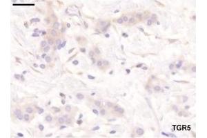 Staining pattern of the antibodies used in the study. (GPBAR1 anticorps  (C-Term))