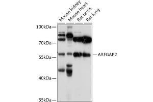 Western blot analysis of extracts of various cell lines, using  antibody (ABIN7265486) at 1:1000 dilution. (arfgap2 anticorps  (AA 242-521))