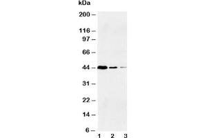 Western blot testing of Caspase-1 antibody and Lane 1:  Jurkat;  2: Raji;  3: CEM (Caspase 1 anticorps  (Large Subunit, N-Term))