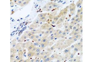 Immunohistochemistry of paraffin-embedded Human liver using RGS5 Polyclonal Antibody at dilution of 1:100 (40x lens). (RGS5 anticorps)
