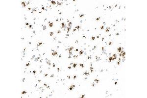 Immunocytochemistry (ICC) image for anti-Tyrosine Hydroxylase (TH) (AA 450-500) antibody (ABIN7449433) (Recombinant Tyrosine Hydroxylase anticorps  (AA 450-500))