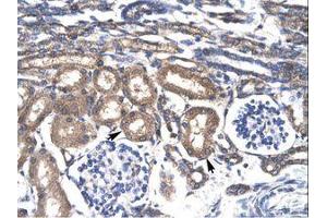 Image no. 2 for anti-Kruppel-Like Factor 8 (KLF8) (AA 89-138) antibody (ABIN6735825) (KLF8 anticorps  (AA 89-138))