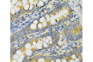 Immunohistochemistry of paraffin-embedded Rat intestine using PGK1 Polyclonal Antibody at dilution of 1:100 (40x lens).