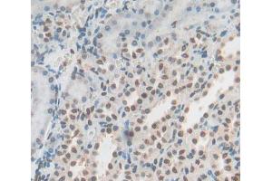 Used in DAB staining on fromalin fixed paraffin- embedded Kidney tissue