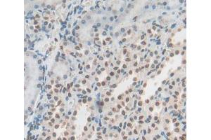 Used in DAB staining on fromalin fixed paraffin- embedded Kidney tissue (YAF2 anticorps  (AA 1-180))
