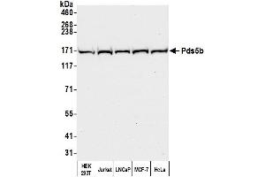 Western Blotting (WB) image for anti-PDS5, Regulator of Cohesion Maintenance, Homolog B (PDS5B) (C-Term) antibody (ABIN7453755)