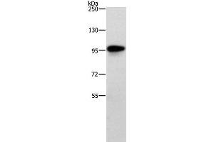 Western Blot analysis of Human brain malignant glioma tissue using TRAF3IP1 Polyclonal Antibody at dilution of 1:500 (TRAF3IP1 anticorps)