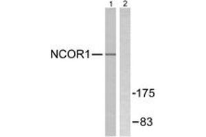 Western blot analysis of extracts from MDA-MB-435 cells, using NCoR1 Antibody. (NCOR1 anticorps  (AA 51-100))