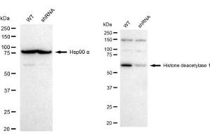 Western blotting analysis using Histone deacetylase 1 antibody (ABIN7798925).