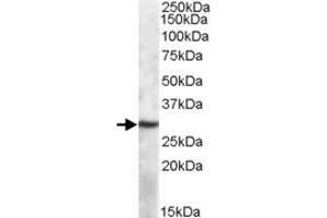 APOBEC1 polyclonal antibody  (1 ug/mL) staining of mouse spleen lysate (35 ug protein in RIPA buffer). (APOBEC1 anticorps)