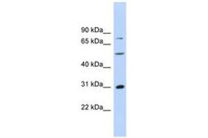 Image no. 1 for anti-Aspartate beta-Hydroxylase (ASPH) (AA 287-336) antibody (ABIN6744502) (Aspartate beta Hydroxylase anticorps  (AA 287-336))