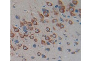 IHC-P analysis of Kidney tissue, with DAB staining. (Calcitonin Receptor anticorps  (AA 34-148))