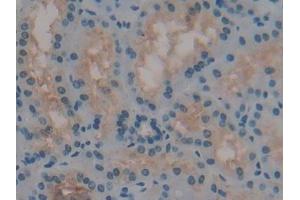 Detection of REN in Human Kidney Tissue using Polyclonal Antibody to Renin (REN)