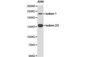 Western Blotting (WB) image for anti-Tet Methylcytosine Dioxygenase 2 (TET2) antibody (ABIN1875061)