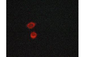 ABIN6267069 staining lovo cells by ICC/IF.