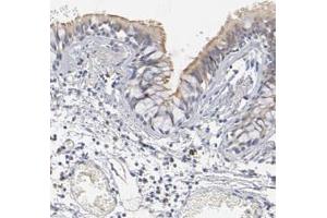 Immunohistochemical staining (Formalin-fixed paraffin-embedded sections) of human bronchus with DNAL4 polyclonal antibody  shows moderate positivity in cilia of respiratory epithelial cells. (DNAL4 anticorps)