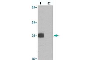 Western blot analysis of EMX1 in rat liver tissue with EMX1 polyclonal antibody  at 1 ug/mL in (lane 1) the absence and (lane 2) the presence of blocking peptide.