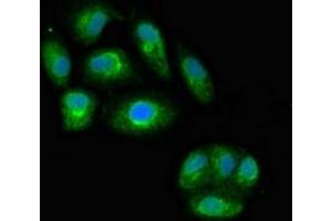 Immunofluorescent analysis of HepG2 cells using ABIN7156868 at dilution of 1:100 and Alexa Fluor 488-congugated AffiniPure Goat Anti-Rabbit IgG(H+L)